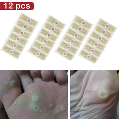 12pcs Medical Plasters Foot Corn Removal Warts Thorn patch Curative Patches Calluses Callosity Detox Foot Pads Patches Medical